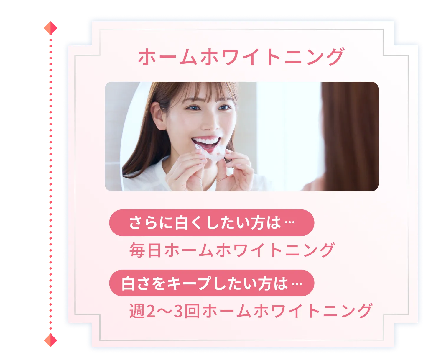 ホームホワイトニング