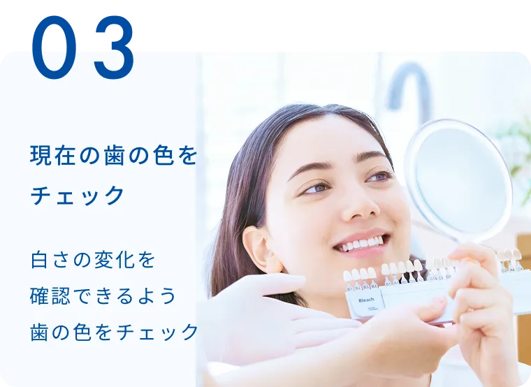 現在の歯の色をチェック 一人ひとりに合うプランを丁寧にご相談