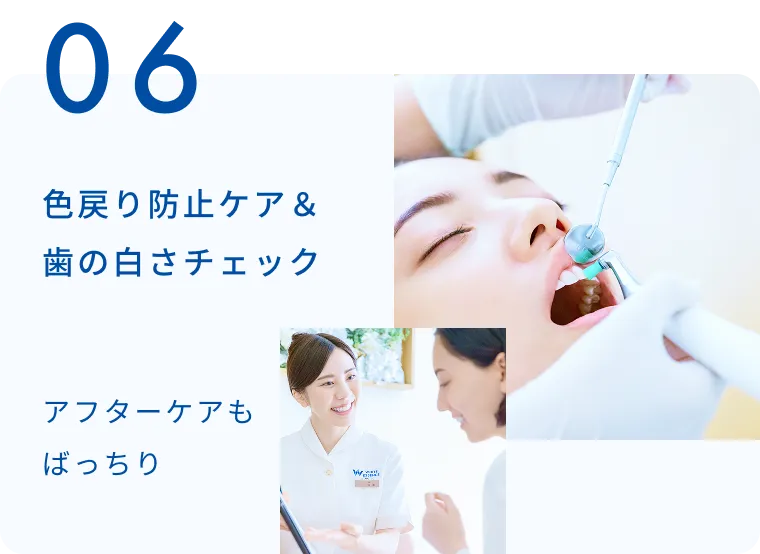 色戻り防止ケア＆歯の白さチェック アフターケアもばっちり