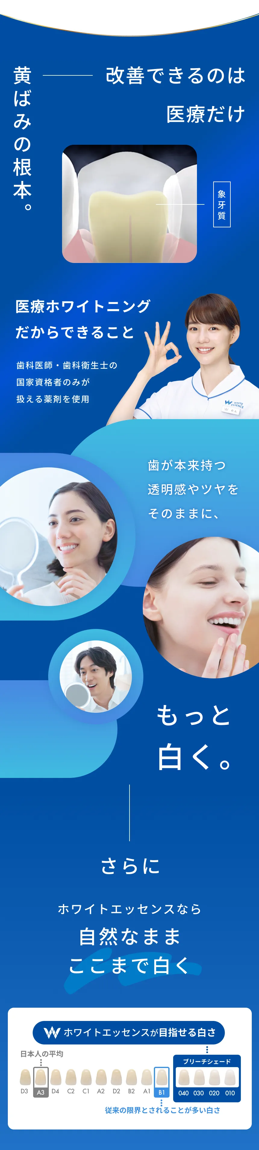 最新ホワイトニングは何が違う？目指せる白さが違う